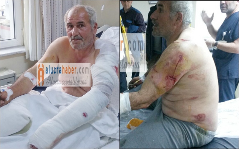 Alucra’da Ayı Saldırısından Mucizevi Kurtuluş