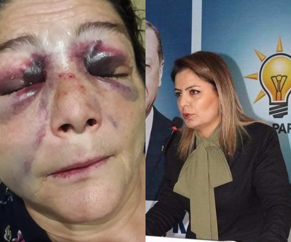 BERRİN AYDIN’DAN EYNESİL’DEKİ KADINA SALDIRIYA KINAMA BERRİN AYDIN’DAN EYNESİL’DEKİ KADINA SALDIRIYA KINAMA